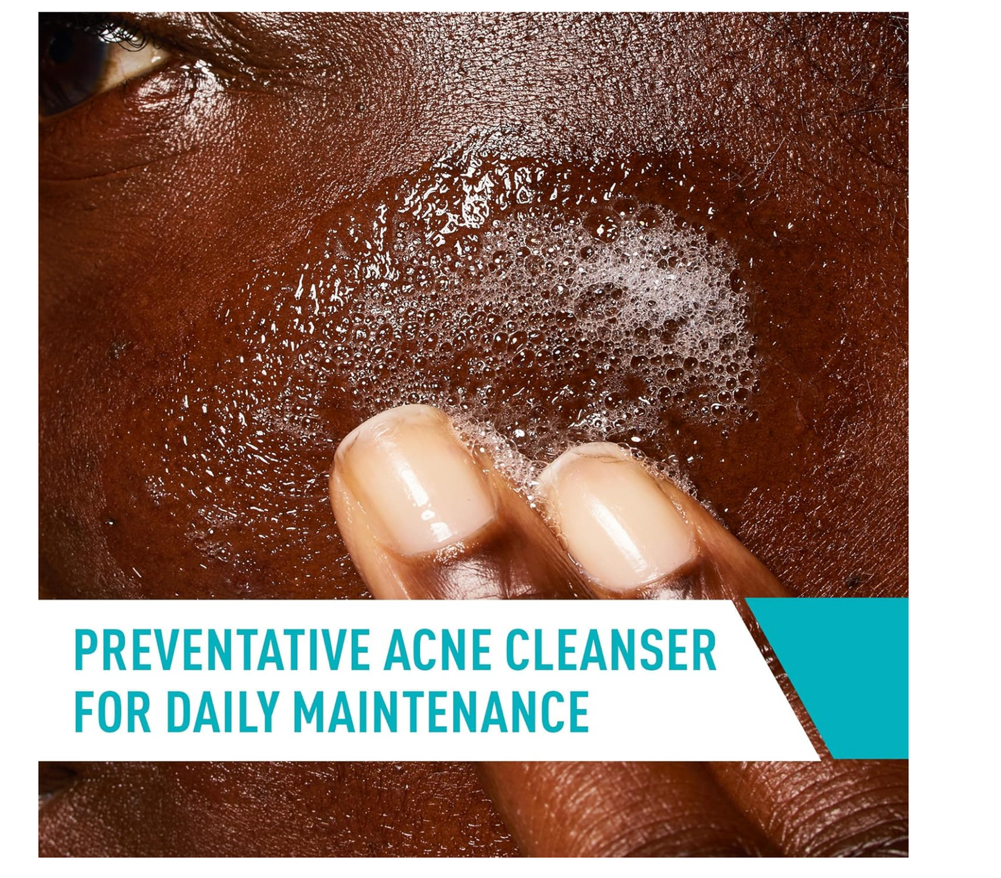 CERAVE: Acne Control Cleanser (2% Saliclylic Acid Acne Treatment) 237mL