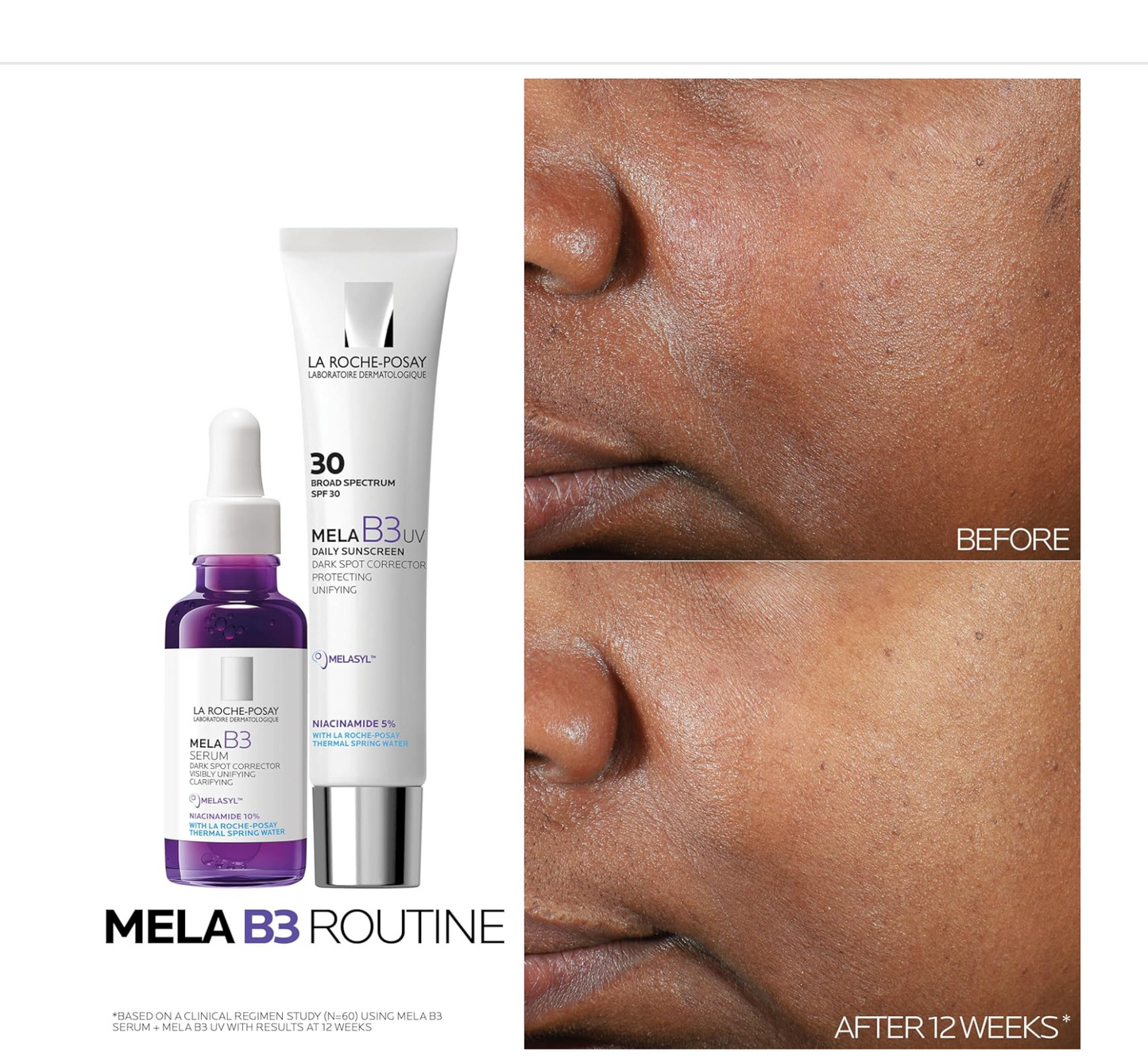 La Roche-Posay: Mela B3 Sunscreen & Face Moisturizer (40mL)