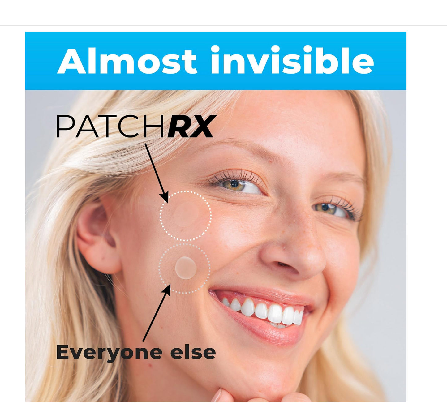 PatchRx Pimple Patches for Face (120 Patches), Hydrocolloid Pimple Patches