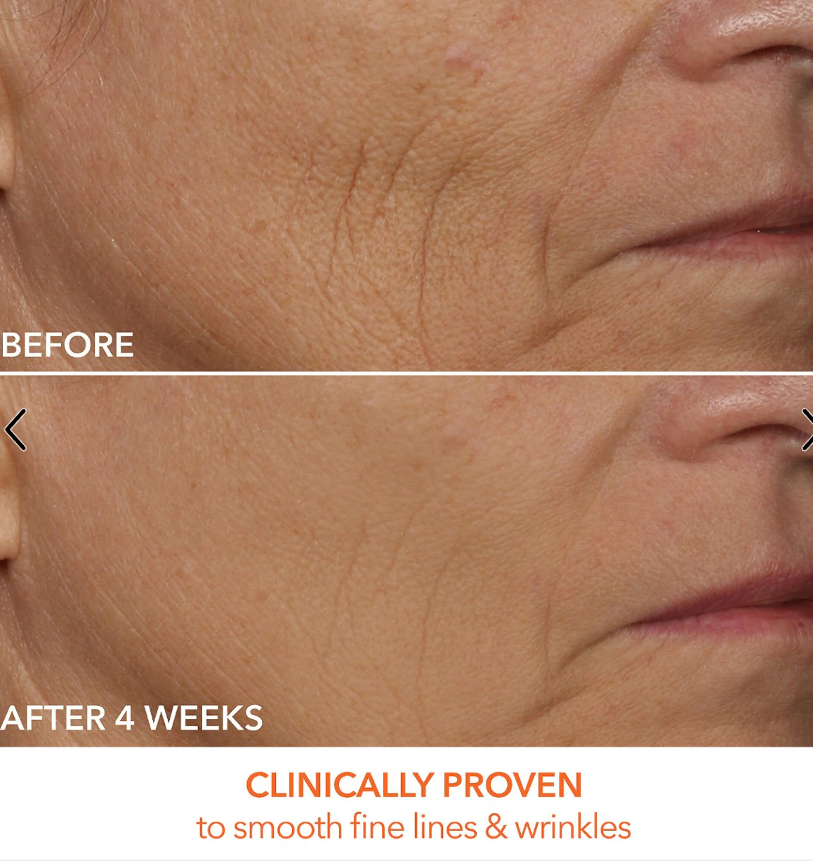 Dr. Dennis Gross Skincare - DRx SpectraLite™ FaceWare Pro