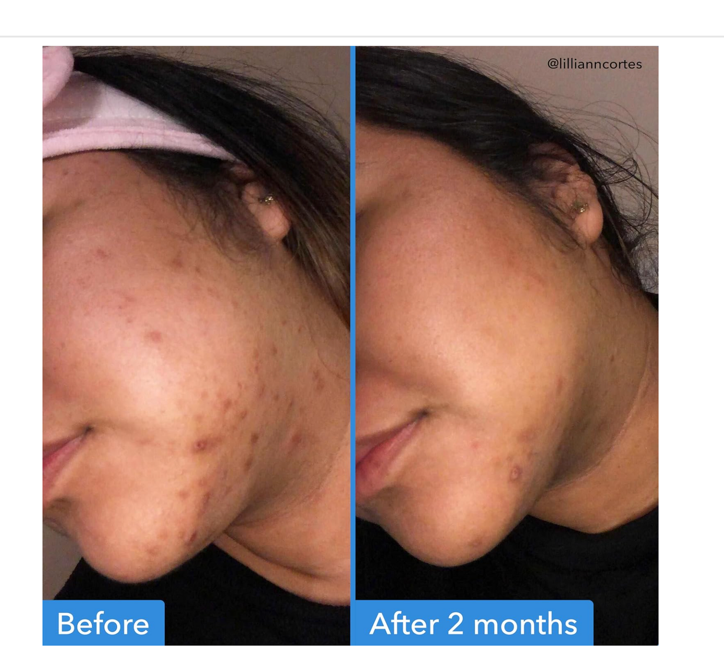 Good Molecules: Discoloration Correcting Serum