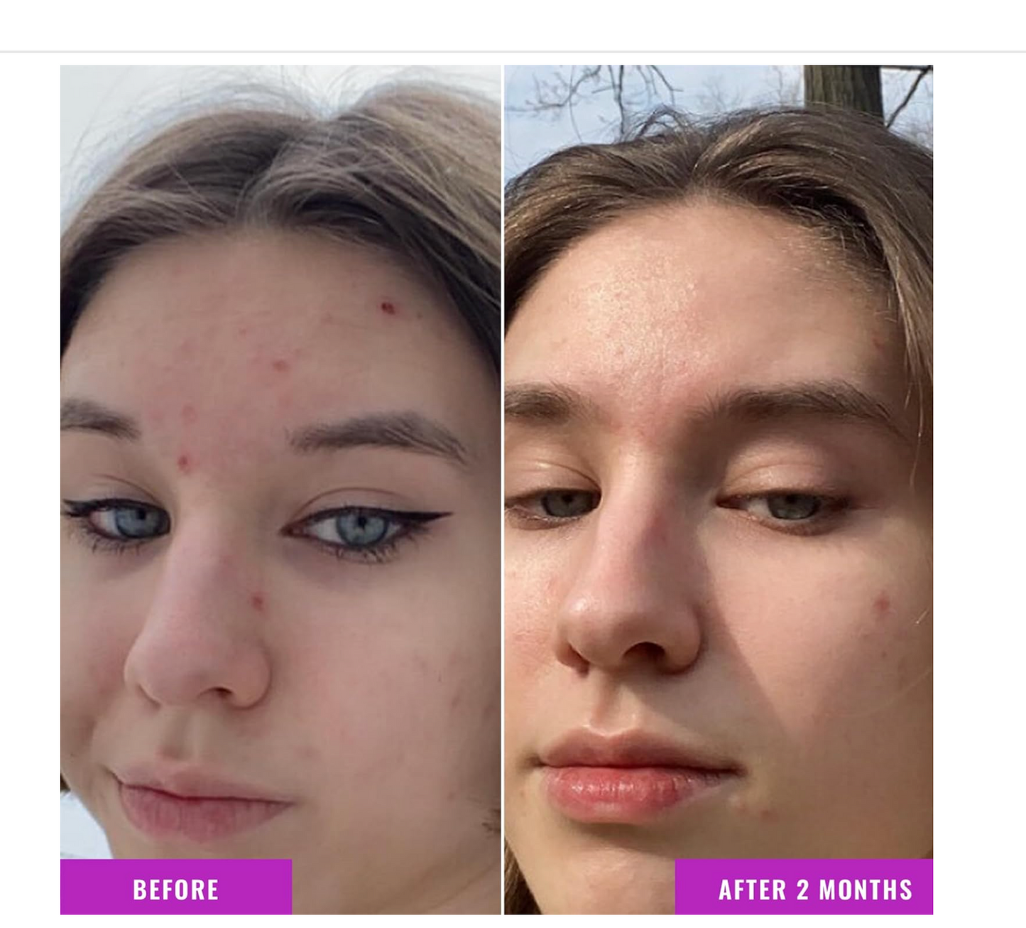 Good Molecules: 10% Niacinamide Serum