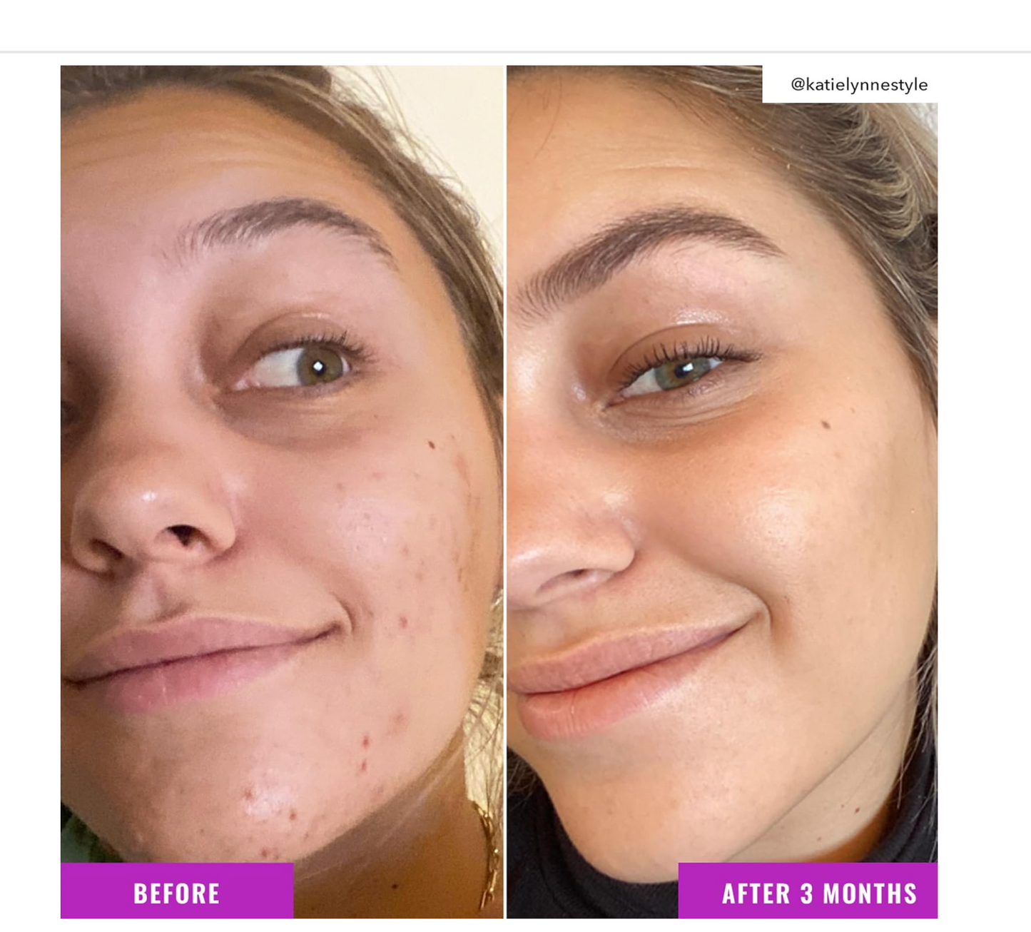 Good Molecules: Niacinamide Brightening Toner