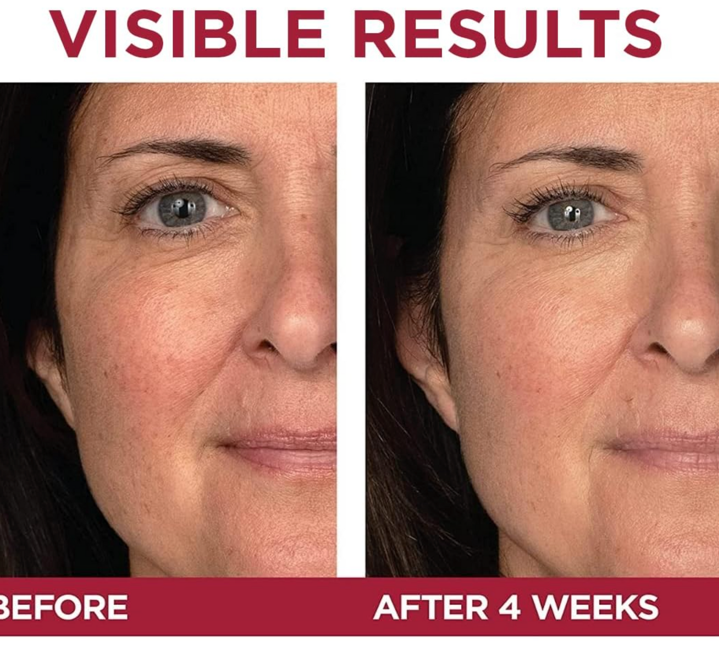 L'Oréal: Revitalift Triple Power LZR Day Lotion (Pro-Retinol + Vitamin C) 50mL