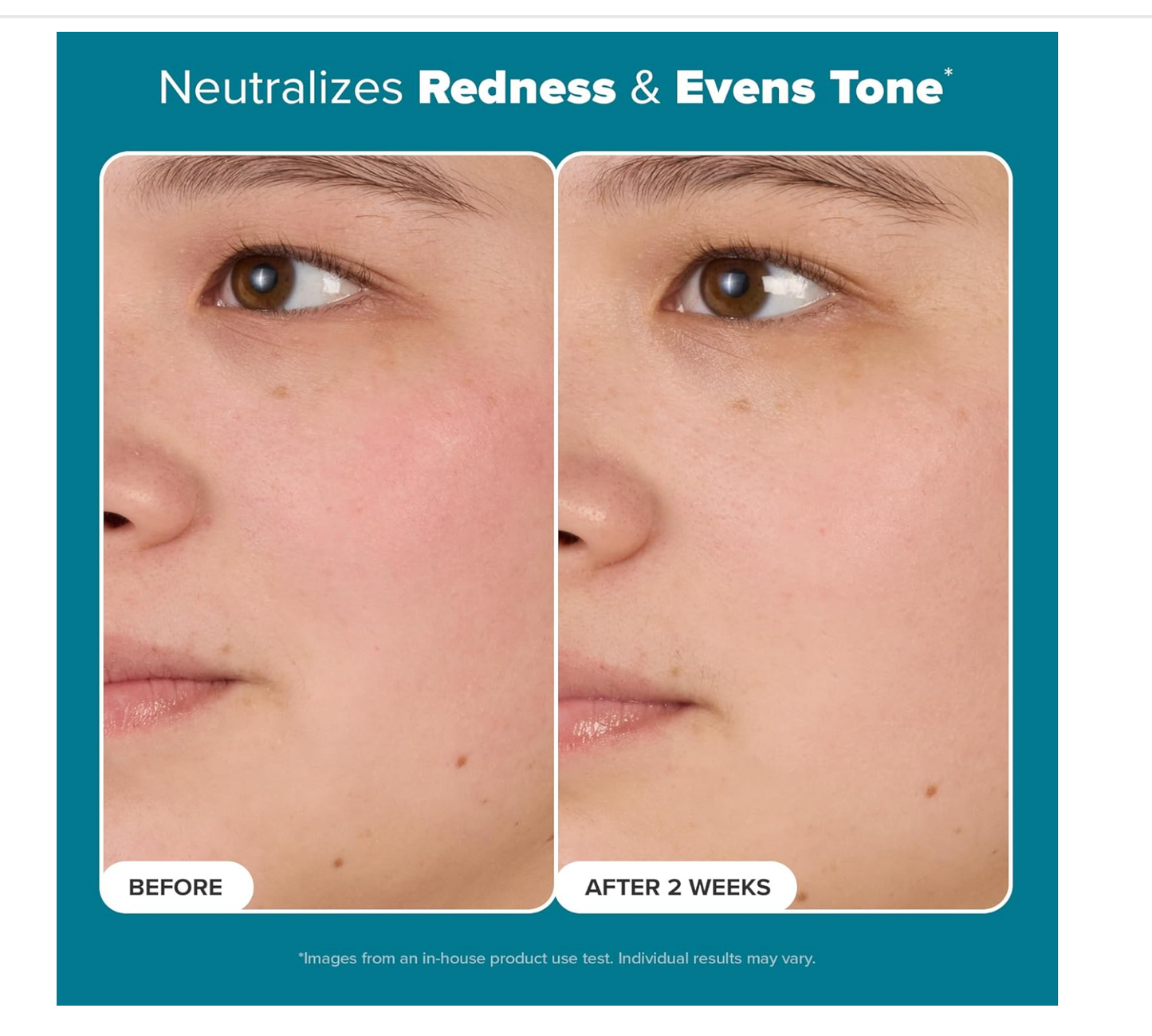 Paula's Choice: Skin Balancing Pore-Reducing Face Toner