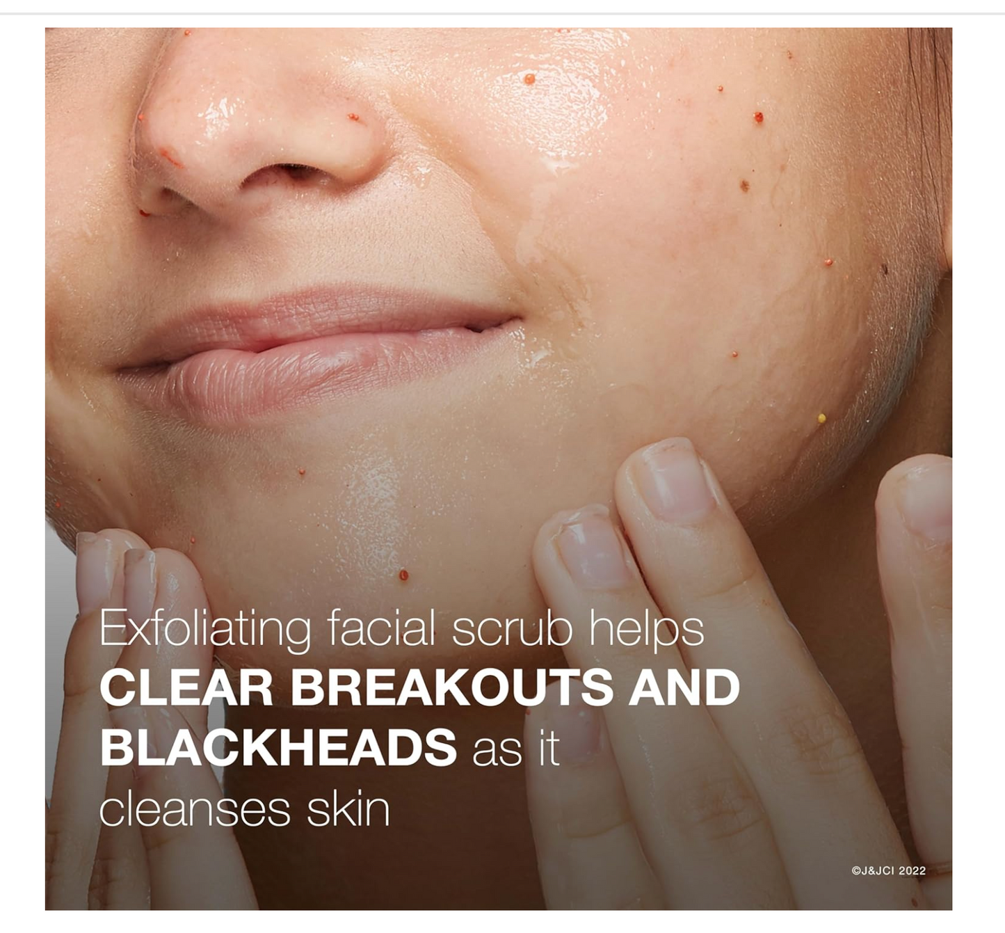 Neutrogena - Oil-Free Acne Wash (Pink Grapefruit Scrub 198 mL)