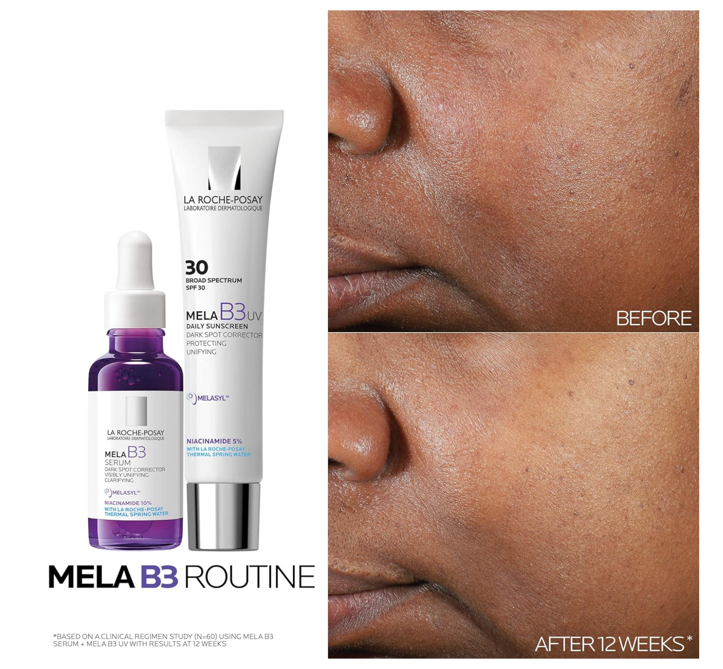 La Roche-Posay: Mela B3 Serum, Dark Spot Corrector