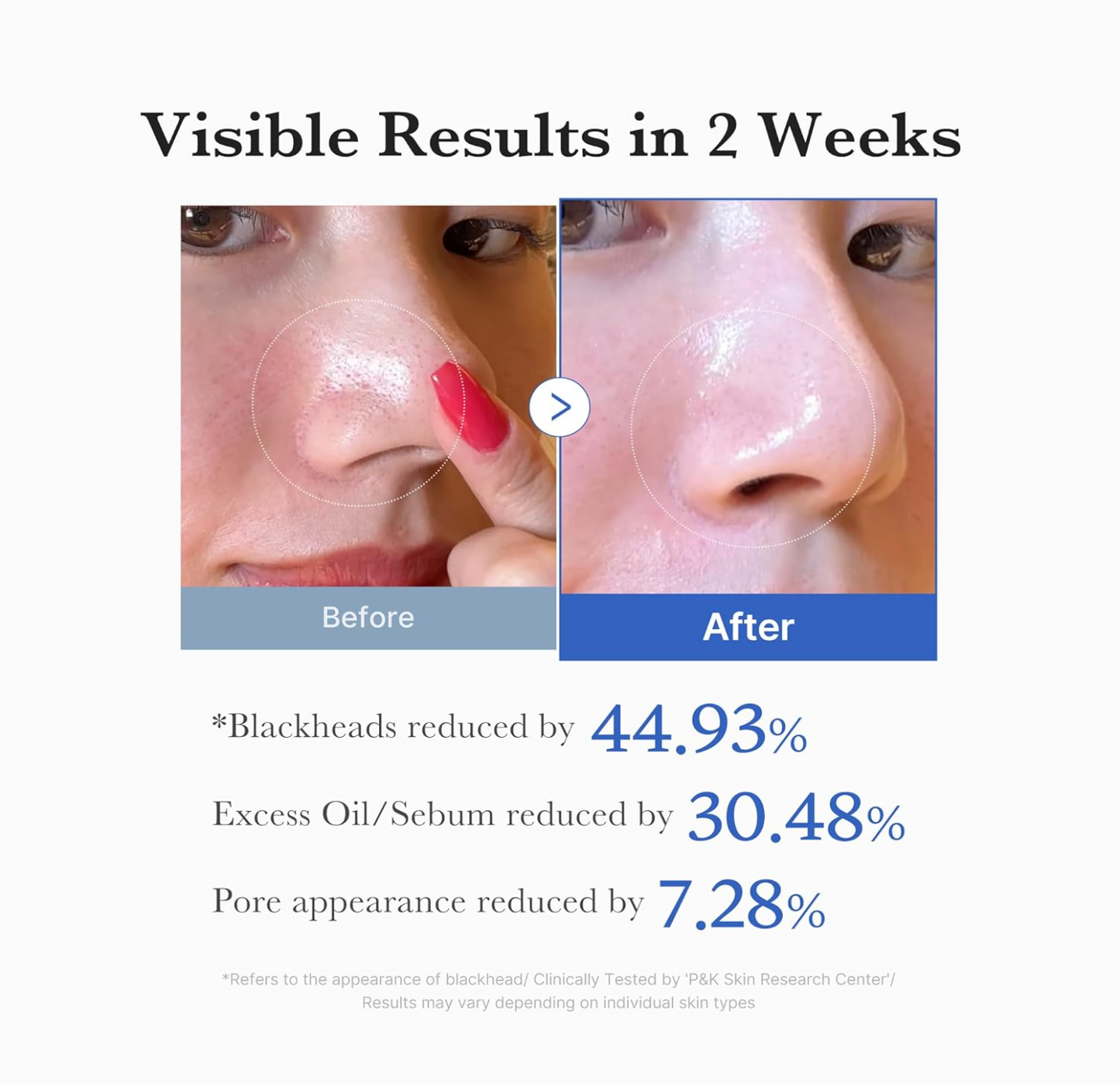 Medicube Toner Pads: Zero Pore Pad 2.0 | 70 Pads